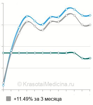 Средняя стоимость электроэнцефалография (ЭЭГ) в Владимире