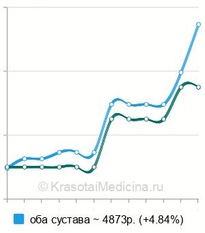 Средняя стоимость МРТ тазобедренного сустава в Владимире