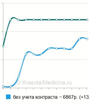 Средняя стоимость МРТ молочных желез в Владимире